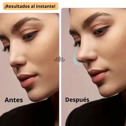 Respingador nasal™ x 3 pares + antironquido